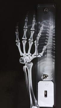 X Ray Rabbit Hand Free Skeleton hand switch Image - Skeleton, Glowing, Hand | Download at ...