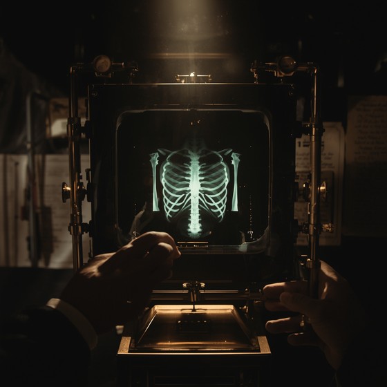 Free Vintage Medical Radiography Image - Vintage, Medical, Xray ...